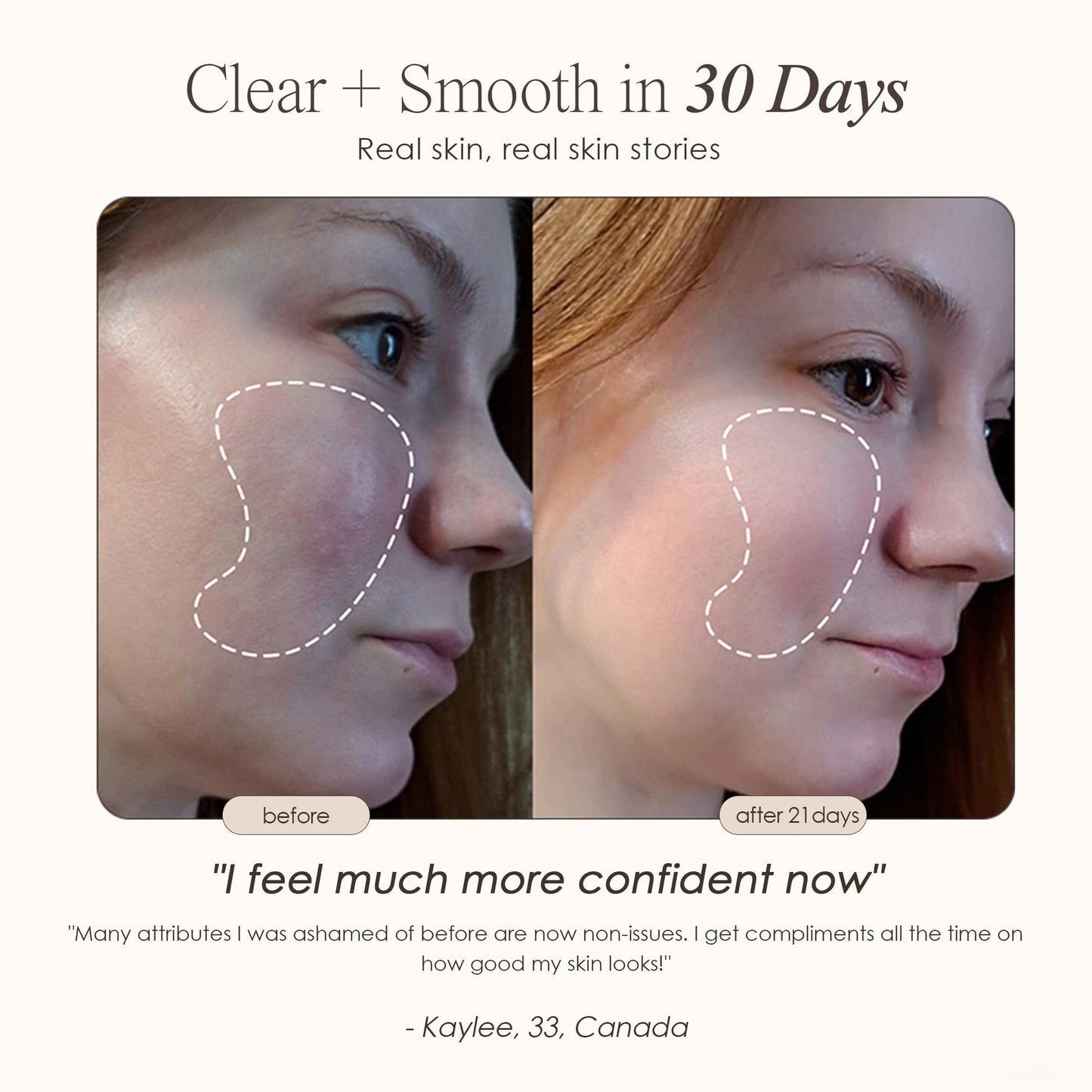 PropeLify High Frequency Wand