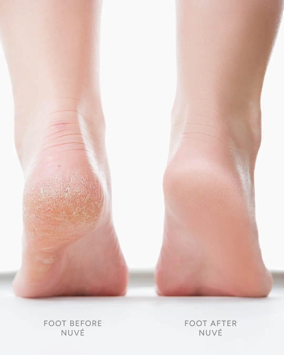 PropeLify® - Silk 3 Pro